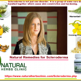 4-Natural-Remedies-for-Scleroderma