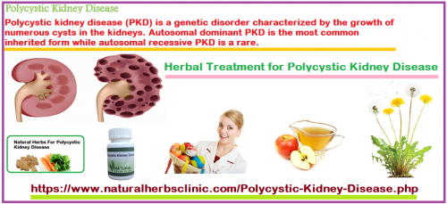 5-Natural-Herbal-Treatments-for-Polycystic-Kidney-Disease.png