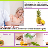 5-Natural-Treatment-for-Peyronies-Disease