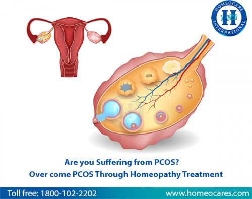 Are-you-Suffering-from-PCOS-Over-come-PCOS-Through-Homeopathy-Treatment.jpg