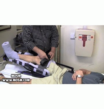 Arthroscopic-Hip-Surgery40a9684247dc99d3.gif