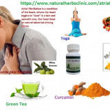 Atrial-Fibrillation-Causes-and-Natural-Treatment