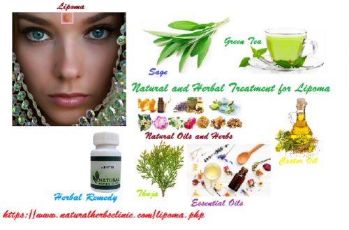 Lipoma Herbal Treatment doesn’t have any side effects and are absolutely safe to use. It is important to keep in mind that these do not create instant results. You have to use them regularly and allow time to show results.... http://naturalherbsclinic.bcz.com/2017/12/19/natural-and-herbal-treatment-for-lipoma/