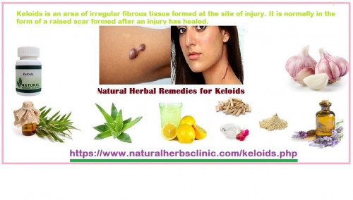 Try out this Keloids Herbal Treatment options for yourself and take before and after pictures to observe the difference.... https://naturalcureproducts.wordpress.com/2017/12/08/benefits-of-herbs-for-keloids-herbal-treatment/
