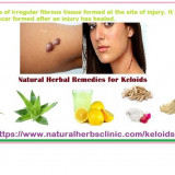 Benefits-of-Herbs-for-Keloids-Herbal-Treatment