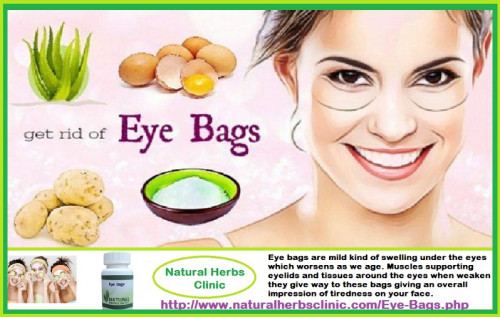 If you want a helpful Best Eye Bag Treatment, then you need to know what to look for. There are so numerous eye creams on the market that do not do what they claim; therefore, if you do not know what to look for, you will possible fall prey to one of them... http://homeremediesforeyebags.blogspot.com/2017/11/best-under-eye-bags-treatment.html
