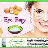 Best-under-Eye-Bags-Treatment