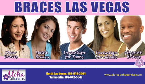 Braces-Las-Vegas5bf77a22a456c603.jpg