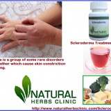 C-Scleroderma-Treatment-Natural-Scleroderma-Alternative-Treatments-Natural-Treatment-for-Scleroderma---Natural-Herbs-Clinic