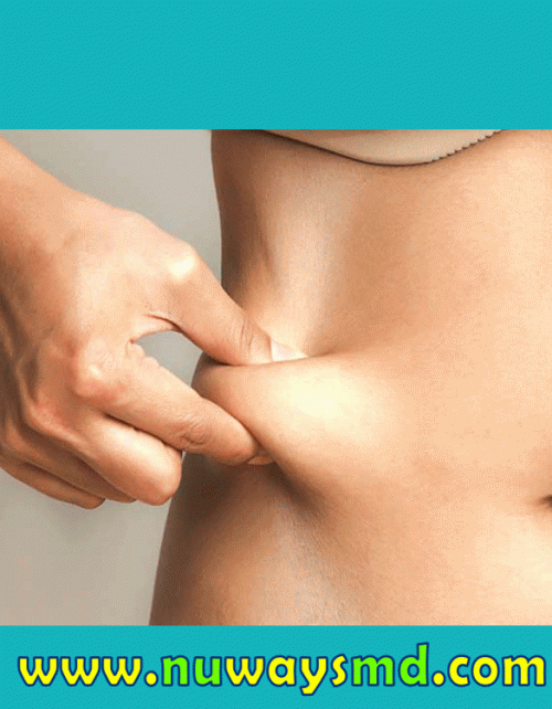 Our Website: http://www.nuwaysmd.com/
As opposed to liposuction surgery, no anesthesia is required for CoolSculpting. During the treatment, people can also use their telephone or laptop computer, read a publication or see a film. The only discomfort people could feel while undergoing Coolsculpting Ft Lauderdale is a feeling of a person pinching or squeezing the fat when the tool wases initially related to the skin. This typically disappears in the very first five minutes of the treatment.