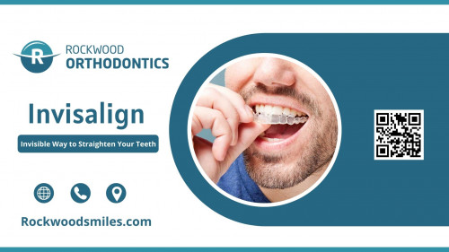 Our Invisalign technique is more effective than other alternatives, bringing quicker recovery with proper usage. Get the invisible solution that enhances your smile.  Schedule an appointment today at info@rockwoodsmiles.com.