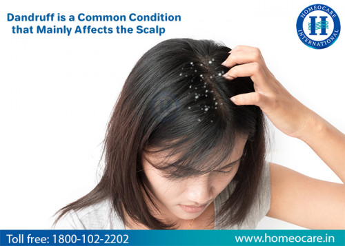 Eliminate-Dandruff-With-Homeopathy-in-Mahabubnagar.jpg