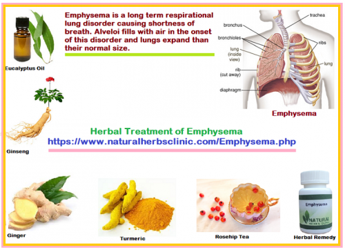 There are numerous Emphysema Cure Home Remedies. These remedies increase health naturally, superbly and securely. The main cause of this disease is long-term connection with cigarettes, smoke or other toxic chemicals. Here we’ve declared certain useful Emphysema Home Remedies... https://naturalcureproducts.wordpress.com/2016/10/10/7-effective-herbs-for-emphysema-herbal-treatment/