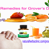 Grovers-Disease-Natural-Treatment-at-Home