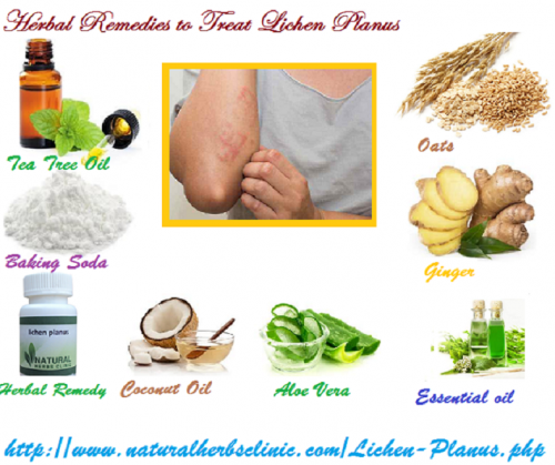 There is no known medical treatment for the disease and the mean of Lichen Planus Herbal Treatment is to clear up the rash and ease the other symptoms.... https://herbalresource.livejournal.com/3238.html