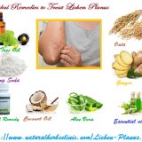 Herbal-Remedies-to-Treat-Lichen-Planus