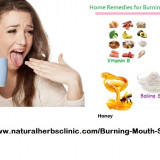 Home-Remedies-for-Burning-Mouth-Syndrome