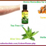 Home-Remedies-for-Lichen-Planus