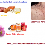 Home-Remedies-for-Seborrheic-Keratosis