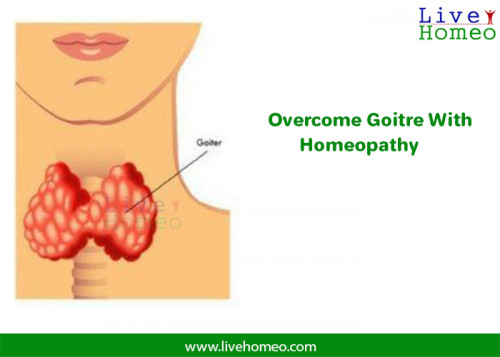 Homeopathy-Clinics-For-Goitre-in-Jubilee-Hills.jpg