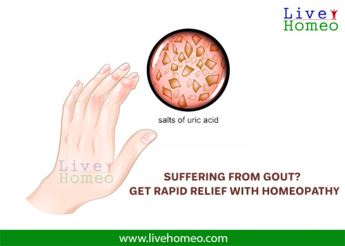 Homeopathy-Treatment-Safely-Cures-Gouty-Arthritis.jpg