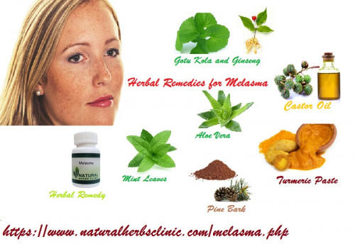 On the other hand, there is the option that a simple, Melasma Herbal Remedies may be just the solution you are looking for... https://herbsmedication.tumblr.com/post/168564209089/how-to-get-rid-of-melasma-naturally-with-herbal
