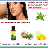 How-to-Improve-Keloid-Scars-With-an-All-Herbal-Treatment