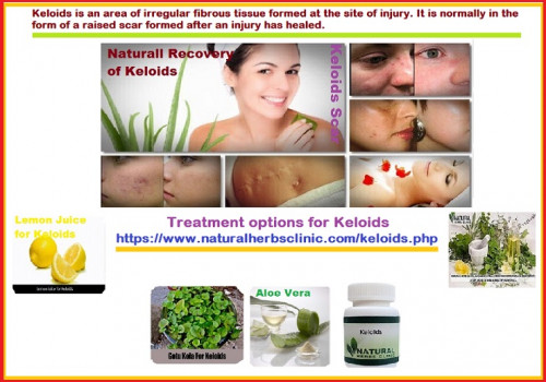 You may or may not have all the connected Keloids Symptoms as this ultimately depends on the cause of the keloid and also your body... https://naturalcureproducts.wordpress.com/2017/12/08/benefits-of-herbs-for-keloids-herbal-treatment/
