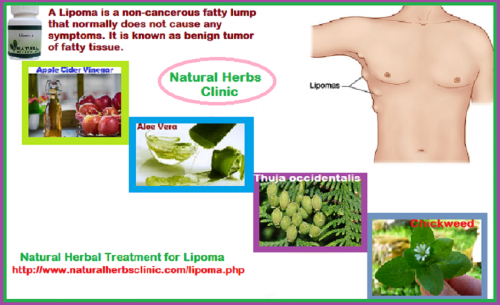 Green tea enhances metabolism and helps to burn fats. It can help to decrease the size of lipoma. It contains antioxidants and regulates blood sugar and fat. Tea can be used in mixture with other Lipoma Remedies as a base, to treat lipoma.... http://www.naturalherbsclinic.com/blog/herbal-treatment-of-lipoma-a-fat-lump/