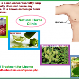 Natural-Herbal-Treatment-for-Lipoma-Fatty-Lumps