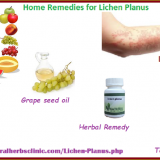Natural-Home-Remedies-for-Lichen-Planus
