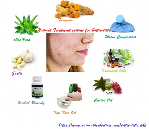 There are various examples of sufferers curing their condition permanently, by choosing to stay away from these drugs and creams, preferring instead to take a more Folliculitis Natural Treatment to their cure.... http://www.naturalherbsclinic.com/blog/natural-proven-way-for-to-folliculitis-treatment/