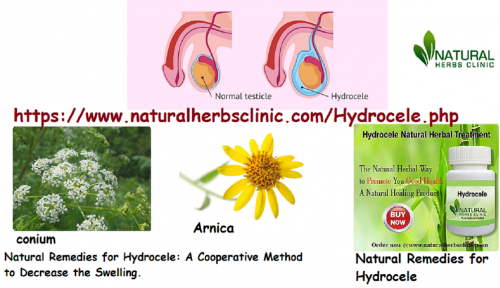 The helpful Natural Remedies for Hydrocele due to injury are conium and arnica. The testicles get inflamed and take on a bluish-red form in cases where arnica will prove the most useful among natural remedies for hydrocele... https://www.flickr.com/photos/189807446@N02/50340578028/