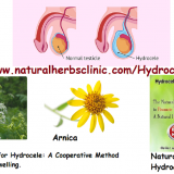 Natural-Remedies-for-Hydrocele-A-Cooperative-Method-to-Decrease-the-Swelling