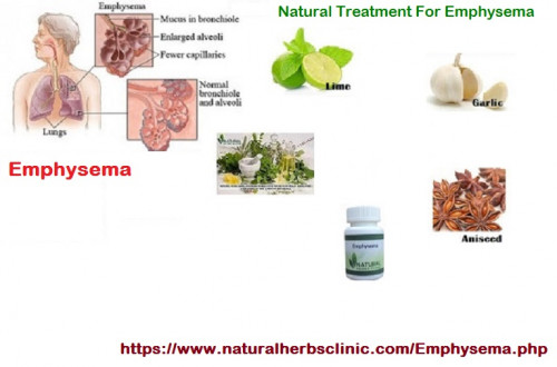As this is a chronic infection of the lungs, Natural Treatment for Emphysema can be precise positive. You must to be patient with the recovery method, as it takes some time to recover completely.... https://naturalcureproducts.wordpress.com/2014/07/26/emphysema-leads-to-decreased-lung-surface-area/