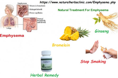 The most vital step in conventional and plan of Natural Treatment for Emphysema is similar. Discontinue any and all types of smoking. Yes, this contains the electronic cigarette. If you smoke, this is the single way to keep Emphysema from getting worse.... https://herbalandnaturalremedies.weebly.com/blog/natural-treatment-for-emphysema