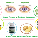Natural-Treatment-for-Blepharitis
