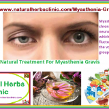 Natural-Treatment-for-Myasthenia-gravis