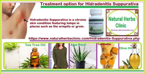 Here are some top tips for the management and Hidradenitis Suppurativa Natural Treatment.... http://naturalherbsclinic.jigsy.com/entries/general/natural-treatment-of-hidradenitis-suppurativa-a-skin-disorder