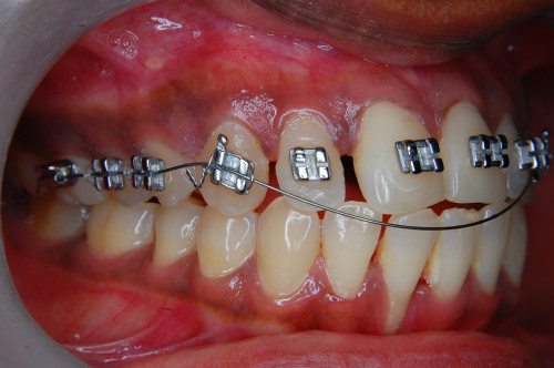 Orthodontist-Las-Vegas.jpg