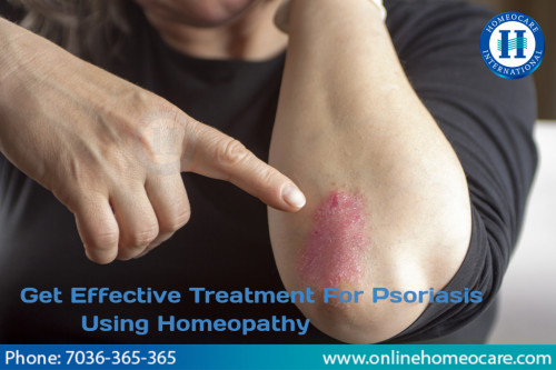 Psoriasis-Treatment-In-Homeopathy.jpg