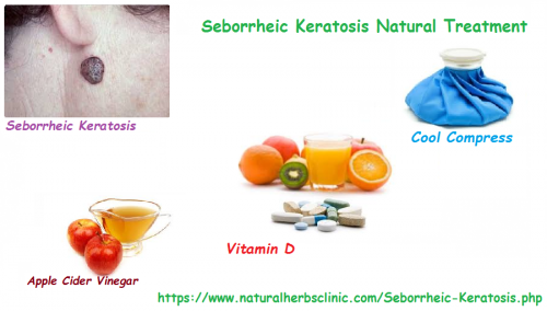 There is a number of Seborrheic Keratosis Natural Treatment accessible. This is a welcome report considering the costly procedures that medical consultants generally use.... https://herbalandnaturalremedies.weebly.com/blog/seborrheic-keratosis-natural-treatment