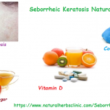 Seborrheic-Keratosis-Natural-Treatment