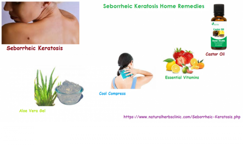 Though, it is vital that an individual recognizes that if they pick to use Seborrheic Keratosis Home Remedies then the fallouts may take slower to display as difference to commercial or scientific treatment.... http://seborrheickeratosisnaturaltreatment.blogspot.com/2016/05/seborrheic-keratosis-natural-treatment.html