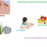 Seborrheic-KeratosisHome-Remedies