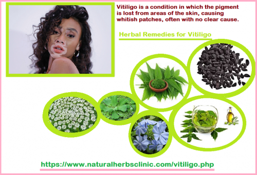 Though, only home remedies and Herbal Remedies for Vitiligo work efficiently. Vitiligo is easily curable at a specific level. There are numerous herbal remedies accessible to cure these vitiligo patches.... https://herbalresource.livejournal.com/2899.html