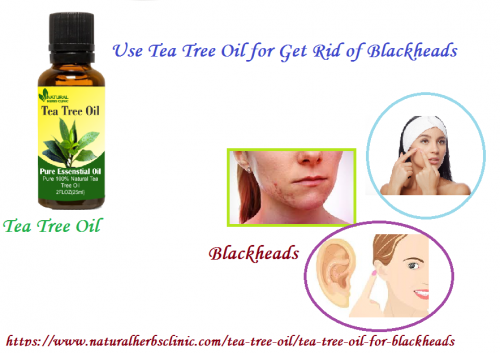 Tea Tree Oil for Blackheads is also good for those who smoke because it has unhealthy particles, like nicotine, that have a negative impact on the skin which leads to the formation of blackheads.... https://www.naturalherbsclinic.com/tea-tree-oil-for-blackheads