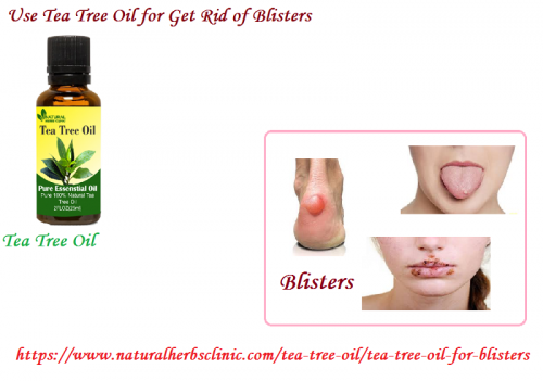 Tea Tree oil for Blisters is rich for its antibacterial properties and then astringent which can dry out from the blister. Plus, it is useful for relieving the inflammation occurring in blister.... https://www.naturalherbsclinic.com/tea-tree-oil/tea-tree-oil-for-blisters