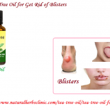 Tea-Tree-Oil-for-Blisters---Natural-Essential-Oils---Natural-Herbs-Clinic