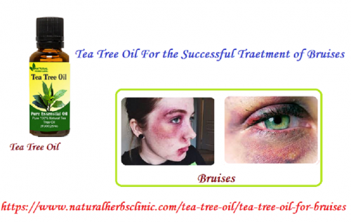 Tea Tree oil for Bruises is best and if you want to speed up healing bruises, then tries to putting a some drops of tea tree oil on the injury, and lightly massaging it.... https://www.naturalherbsclinic.com/tea-tree-oil/tea-tree-oil-for-bruises